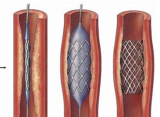圖片關(guān)鍵詞